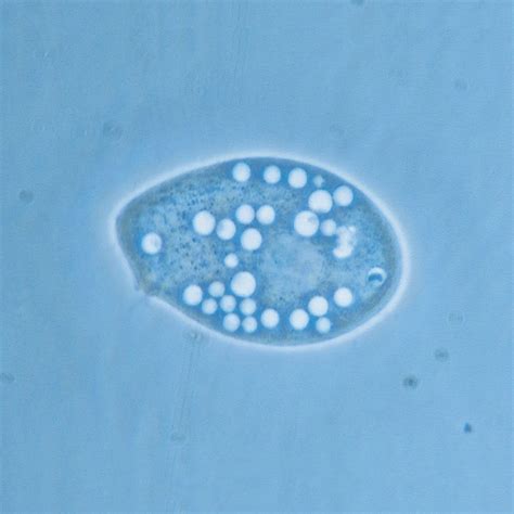  Tetrahymena! En mikroskopisk mästare på cellulär dans och fagocytos