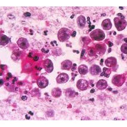  Naegleria Fowleri: En Microskopakt Mikroben Med Ett Gömställe I Värmen Och En Försmak För Den Centrala Nervsystemet! 