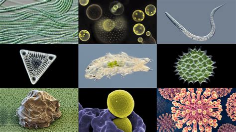  Quadrifilida!  En Mikroorgansm Med En Fascinerande Historia