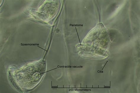   Vorticella! En Mikroorganismer Med Spiralformiga Tandmaskiner